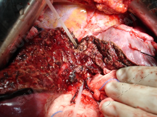 tyc7111cc太阳成集团